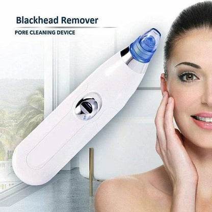 4-in-1 Blackhead Extractor